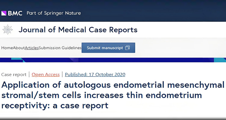 干細(xì)胞治療子宮內(nèi)膜薄弱臨床研究進(jìn)展